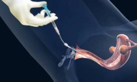 重庆私立试管婴儿医院价格参考